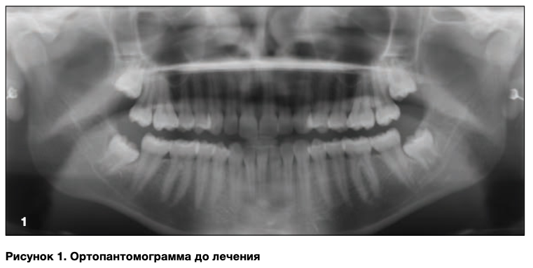 Снимок экрана 2020-06-10 в 15.18.04